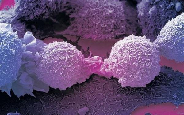 Immune discovery 'may treat all cancer' News Image