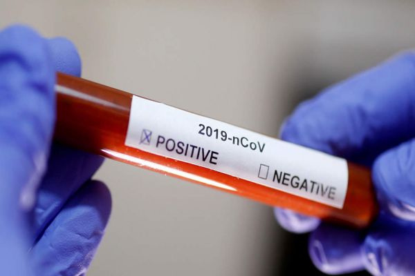 New report on 138 Coronavirus cases reveals disturbing details New report on 138 Coronavirus cases reveals disturbing details