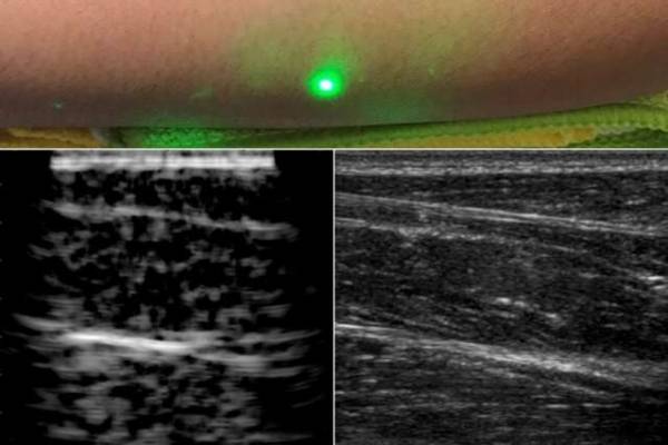 Researchers produce first laser ultrasound images of humans Researchers produce first laser ultrasound images of humans