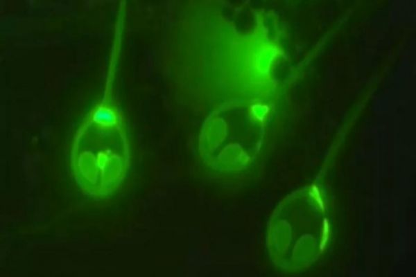 Scientists discover animal that doesn't breathe oxygen Scientists discover animal that doesn't breathe oxygen